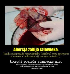 aborcja-zabija-czlowieka